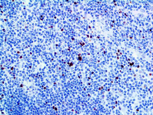 IHC of FOXP3 on an FFPE Tonsil Tissue
